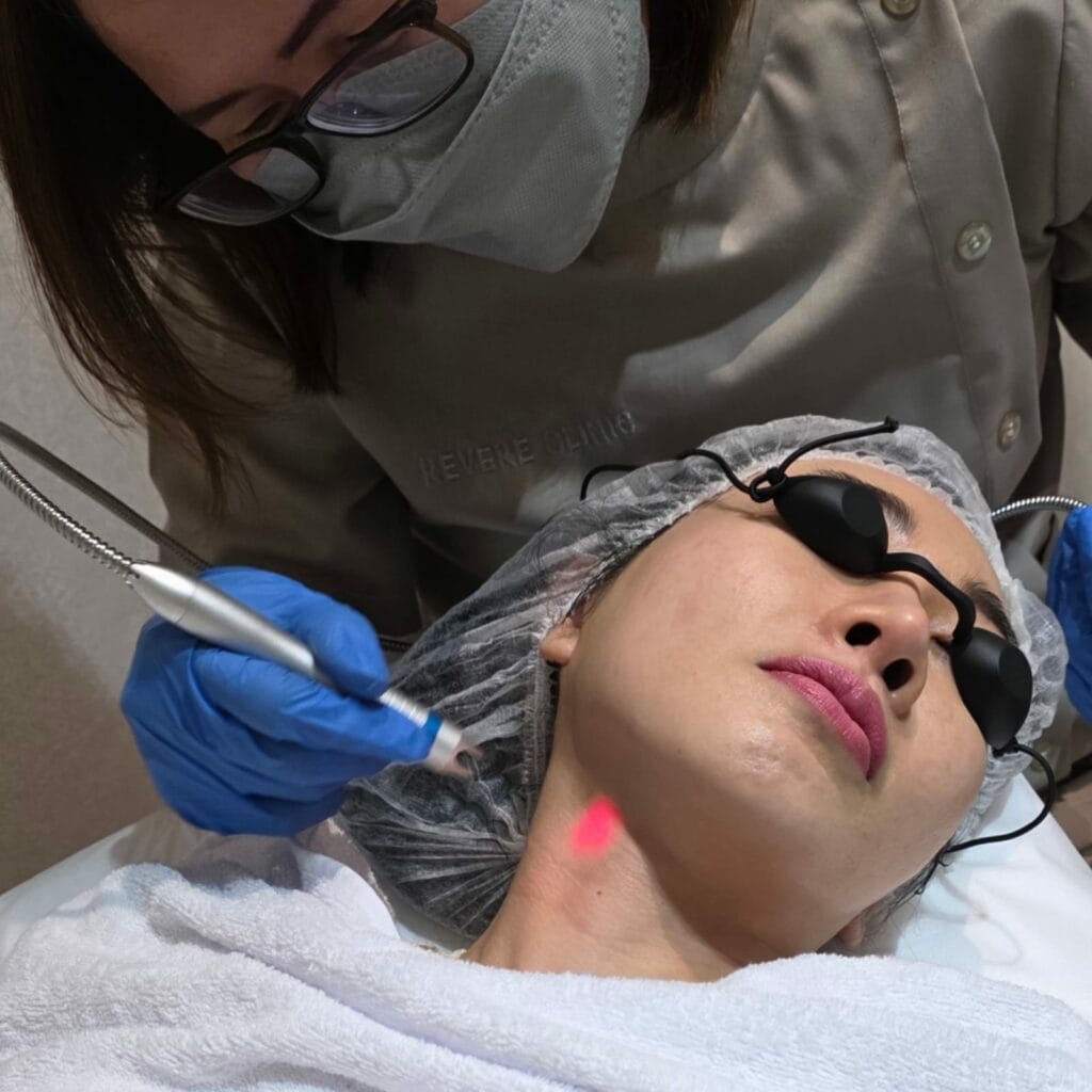 Skin Rejuve Laser
