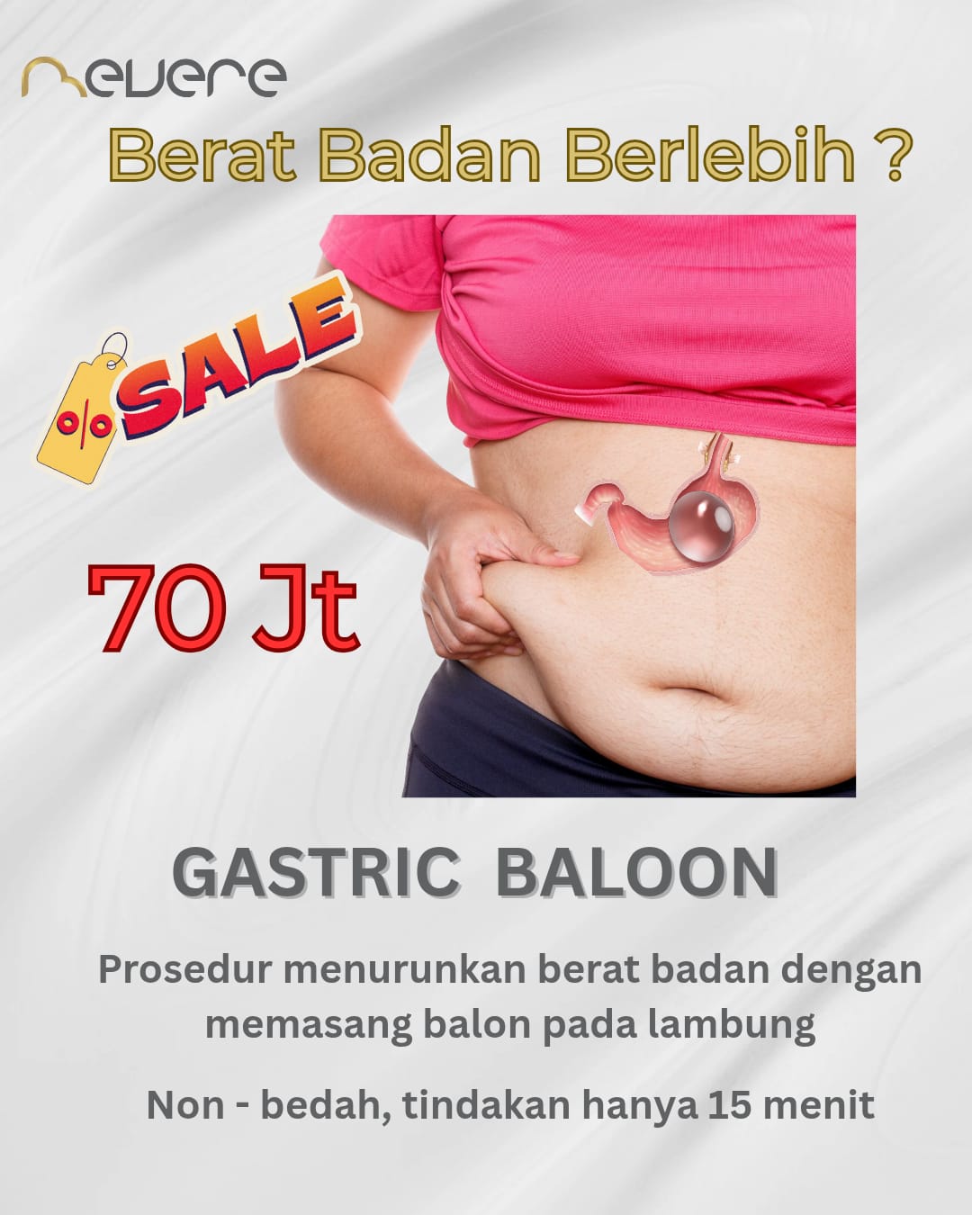 Balon Lambung Slimming