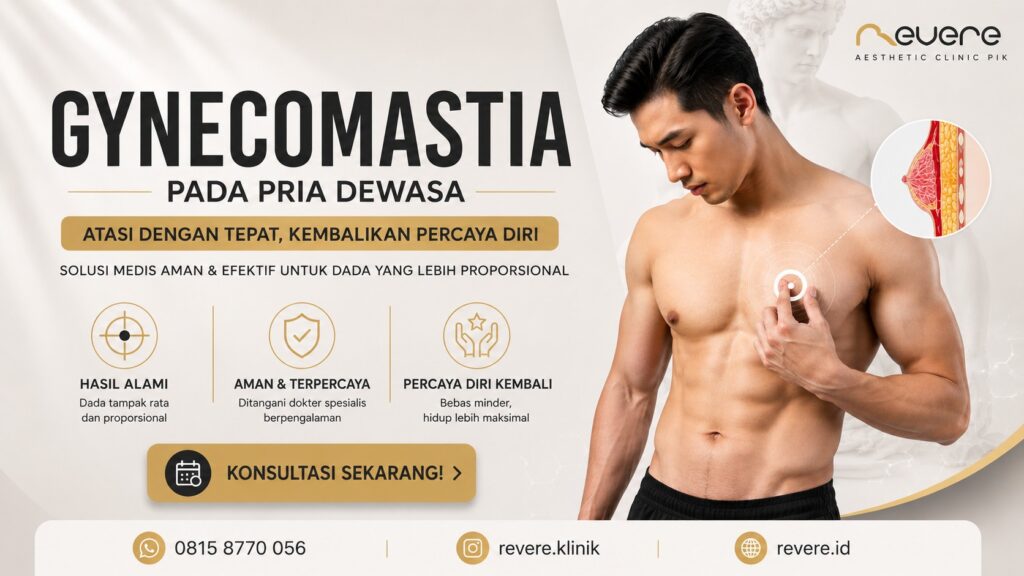 Gynecomastia 0815 8700 056