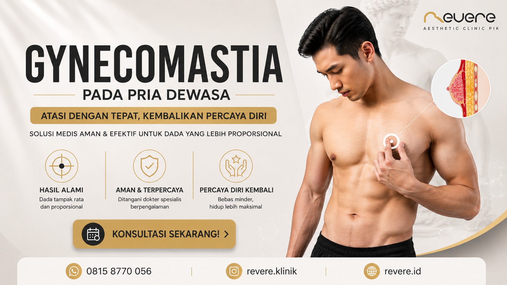 Gynecomastia 0815 8700 056